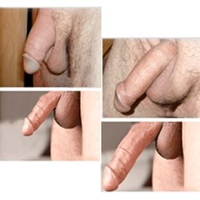 Results before and after using Big Size gel on penis